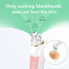 Image of High definition visual electric blackhead absorber Shopping111