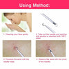 Image of Ear Wax Remover Spoon Earwax Picker And Pimple Blackhead Remover Tools - COMBO KIT Shopping