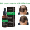 Image of Hair Growth Oil Hair Growth Oil Oem Hair Care Essential Oil Shopping111