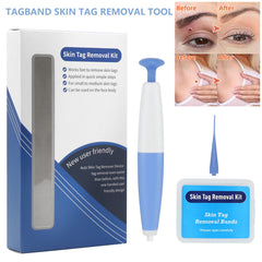 Skin Tag Removal Kit Home Use Mole Wart Remover Micro Band Skin Tag Treatment Tool Easy To Clean Skin Care Tool Shopping111