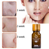 Image of Dredge Meridian Skin Care Natural Pure Removal Acne Stretch Marks Scar Removal Essence oil Shopping111