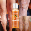 Image of Orange Peel Lotion Peeling Oil Body Lotion Gentle Exfoliation Shopping111