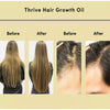 Image of Hair Essential Oil Improve Dryness And Irritability And Nourish Shopping111