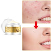 Image of Snail Rejuvenating Face Cream Hyaluronic Acid Moisturizer Anti Aging Collagen Skin Care Health Nourishing Serum Shopping