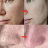 Image of Pore Shrinking Serum Peeling Face Removing Large Pores Tightening Repairing Facial Pore Minimizing Effective Exfoliation Skin Shopping111.com