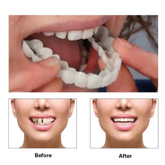 Instant Perfect Fit Teeth Whitening Fake Tooth Cover Snap On Silicone Smile Veneers Teeth Dentaduras Flexibles Beauty Tool Shopping111