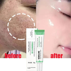 Salicylic Acid Pore Shrinking Cream Quick Elimination Large Pores Remove Blackehead Tighten Face Smooth Skin Korean Care Product Shopping111.com