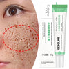 Image of Salicylic Acid Pore Shrinking Cream Quick Elimination Large Pores Remove Blackehead Tighten Face Smooth Skin Korean Care Product Shopping111.com