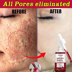 Pore Shrinking Serum Peeling Face Removing Large Pores Tightening Repairing Facial Pore Minimizing Effective Exfoliation Skin Shopping111.com