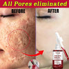 Image of Pore Shrinking Serum Peeling Face Removing Large Pores Tightening Repairing Facial Pore Minimizing Effective Exfoliation Skin Shopping111.com