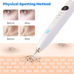 Laser Skin Tag Remover Face Mole Remove Plasma Pen Freckle Removal Machine Plasma Remove Scar Black Spot Face Wart Tattoo Device Shopping111