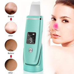 Ultrasonic Vibration Blackhead Remover Deep Cleansing Face Scrubber Pore Cleaner Lifting Machine Facial Led Peeling Shovel Shopping111